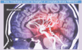 Thumbnail for version as of 16:57, 28 July 2021