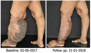 Fig 9-The patient arrived for treatment.jpg